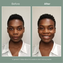 Load image into Gallery viewer, 2 X MICROSTEM SHAMPOO SUB CMS
