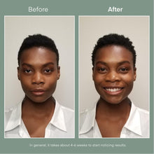 Load image into Gallery viewer, 1 Bottle of Microstem Conditioner - Save 50%
